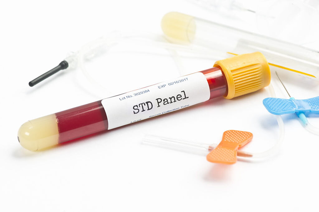 Three Types Of STD Tests: Which Should You Choose?